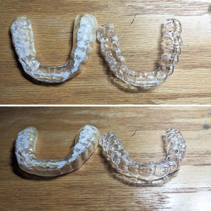 Two Years Of Grinding My Teeth Versus The New Replacement