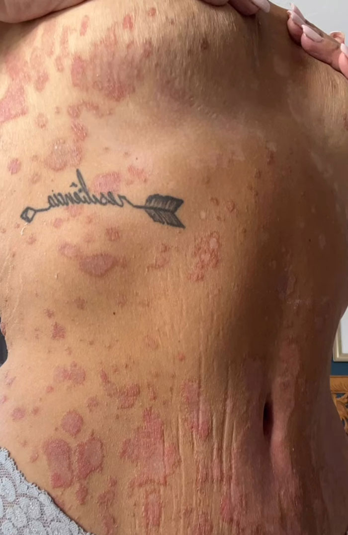 Weight Loss Influencer Mila De Jesus, Who Went Viral For Her Transformation, Passes Away At 35 Weight Loss Influencer Mila De Jesus, Who Went Viral For Her Transformation, Passes Away At 35