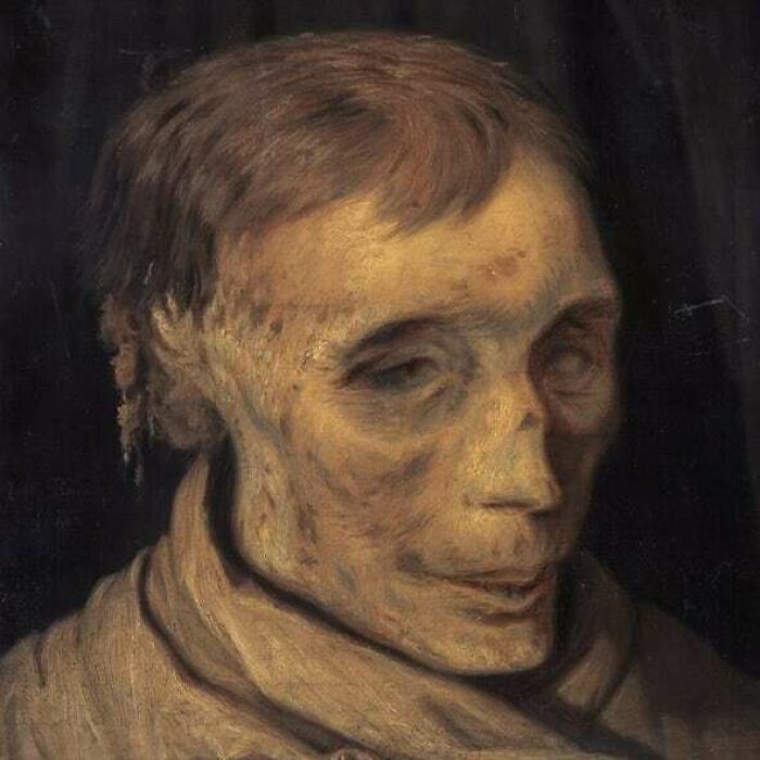 Otto Bache "Study Of The Mummified Head Of James Hepburn, 4th Earl Of Boswell, C.1535-1578"