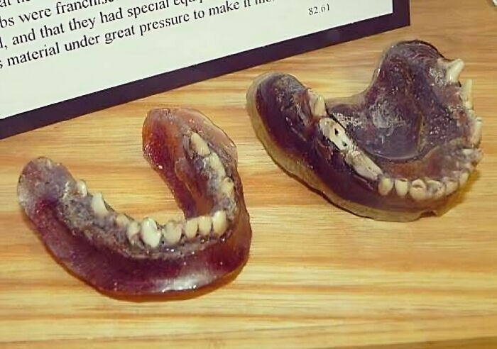 In The Early 1900s A Man Couldn't Afford Proper Dentures, So He Made His Own Using Melted Down Toothbrush Handles And The Teeth Of A Dead Coyote
