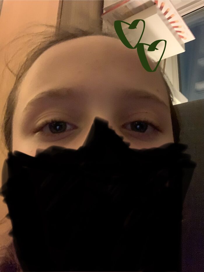 Very Bad Editing, I Know. Top Half (Ish) Of My Face Reveal (Mostly Because It Looked Weird With It Drawn All Over£