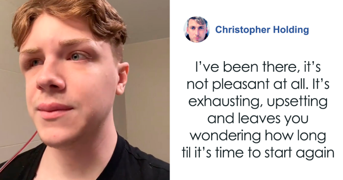 Man Who Underwent Skull Removal Surgeries To “Wash” His Brain Gets Denied Disability Benefits