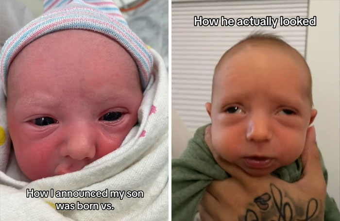 People-Share-Ugly-Newborn-Photos