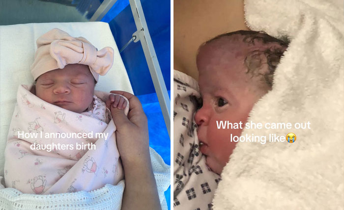 People-Share-Ugly-Newborn-Photos
