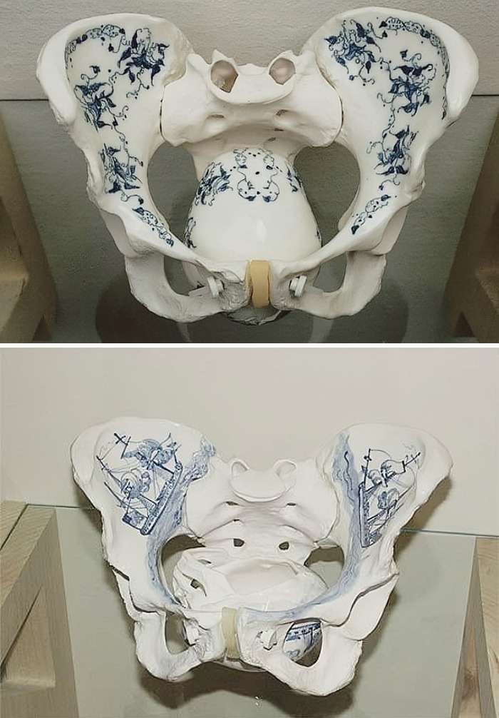 Christine Borland, Set Conversation Pieces (Detail), 1998⁣. ⁣ ⁣ Set Of Five Pelvises Containing Fetal Skulls, Which Borland Based On Antique Obstetric Models