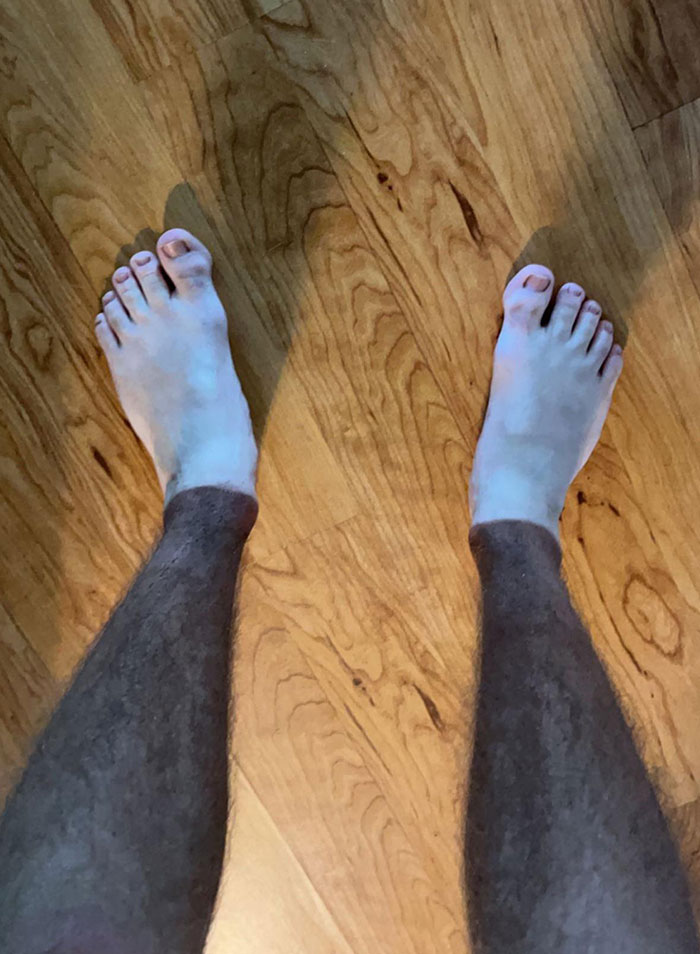 My Tan Lines Make Me Look Like I’m Wearing Necropants