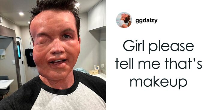 Rob McElhenney’s Fans Disturbed As Actor Shares New Year’s Eve Photo Of His “Swollen” Face