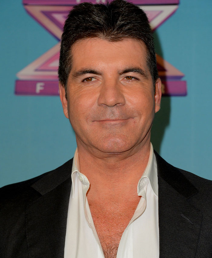 “What On Earth Has He Done?“: Simon Cowell Reveals Dramatic Facial Change