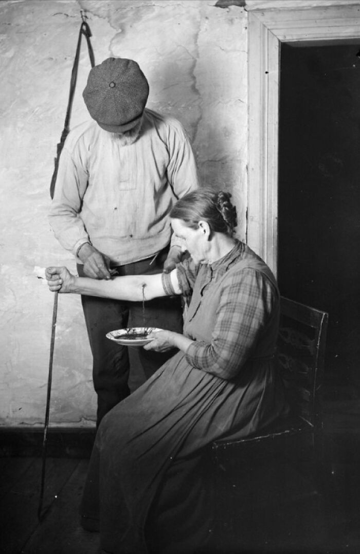 This Photo Was Taken By Ethnologist Nils Keyland In Mangskog Parish, Värmland, Sweden In 1922. The Man Is Holding A Type Of Bloodletting Instrument Known As A Fleam