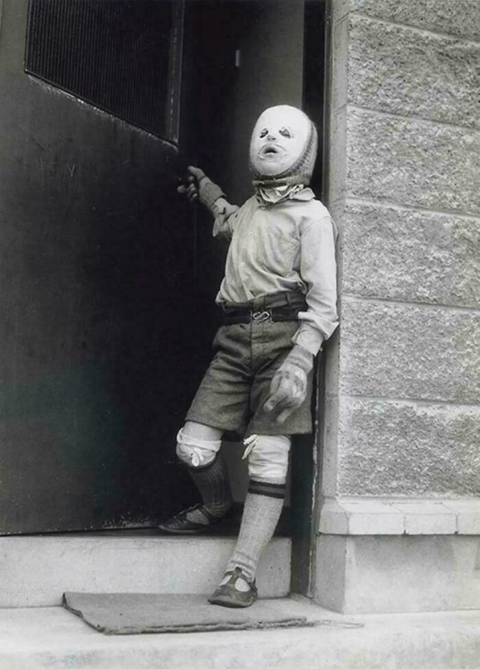 8-Year-Old Freddie Mcintosh In A Sun Protection Suit