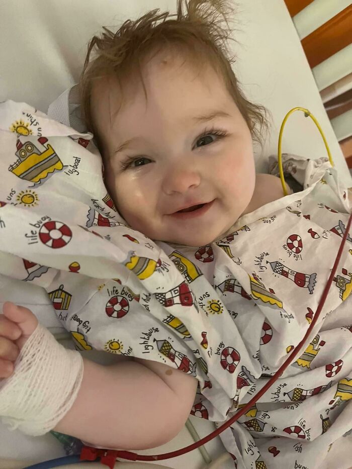 My 8-Month-Old Daughter Woke Up Smiling After Her Brain Surgery