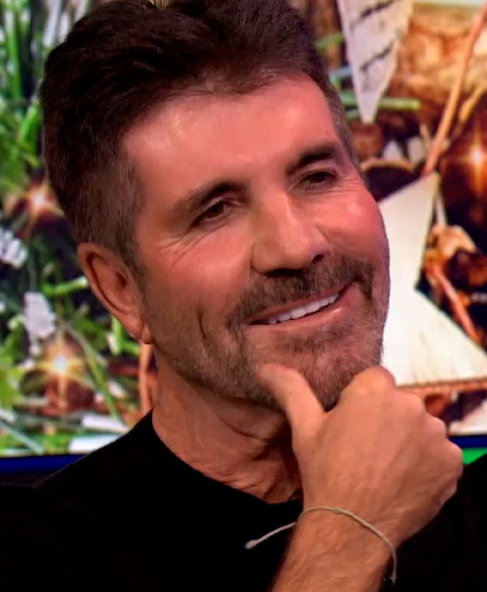 “What On Earth Has He Done?“: Simon Cowell Reveals Dramatic Facial Change