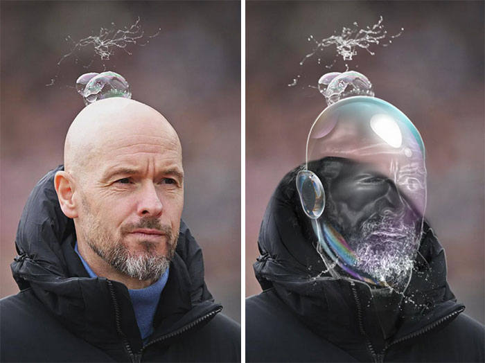 A Bald Soccer Coach With A Bubble On His Head