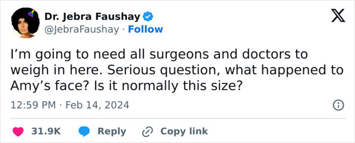 “I Feel Strong And Beautiful”: Amy Schumer Responds To Body-Shaming Trolls In Powerful Post “I Feel Strong And Beautiful”: Amy Schumer Responds To Body-Shaming Trolls In Powerful Post