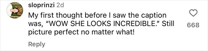 “The Reality Of Motherhood”: Serena Williams Posts Bikini Pic To Promote Body Positivity After Pregnancy “The Reality Of Motherhood”: Serena Williams Posts Bikini Pic To Promote Body Positivity After Pregnancy