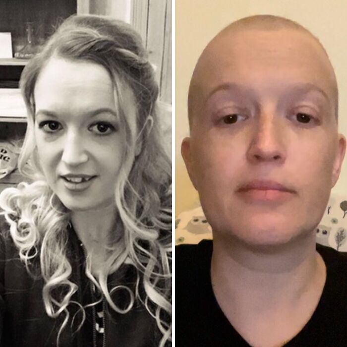 Hey Pandas, I Need Help And Support For My Cancer And Chemotherapy Journey