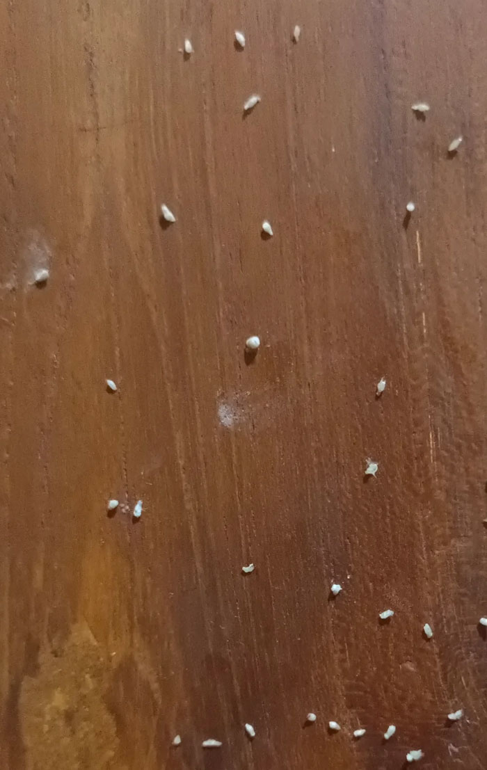 My Acne Starts Breaking Out Again, Here's Some Of The Whiteheads