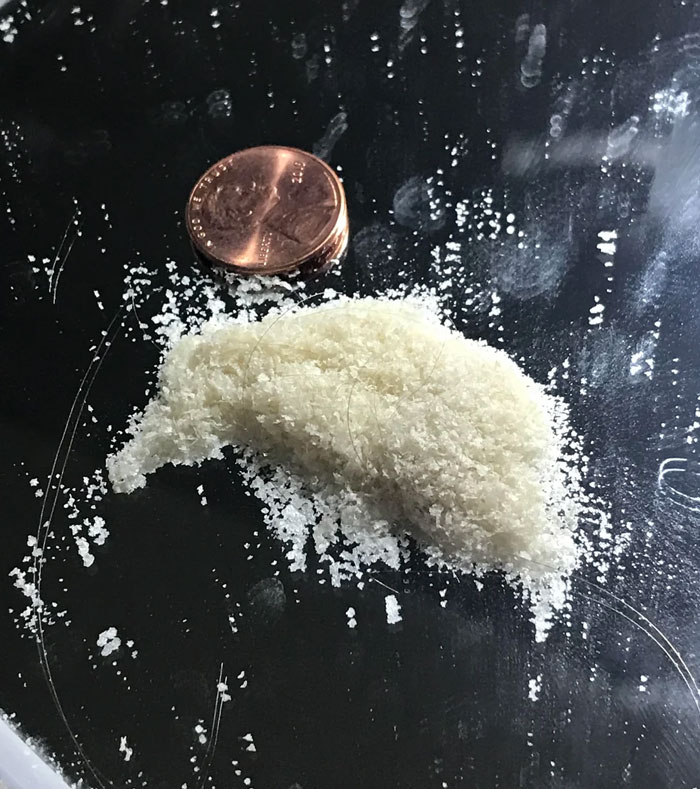 I Have Moderate-Severe Scalp Psoriasis And Have To Scrape My Scalp Several Times A Week. This Is The Result Of A Single Session After Having Already Done It A Few Days Prior. (Penny For Scale)