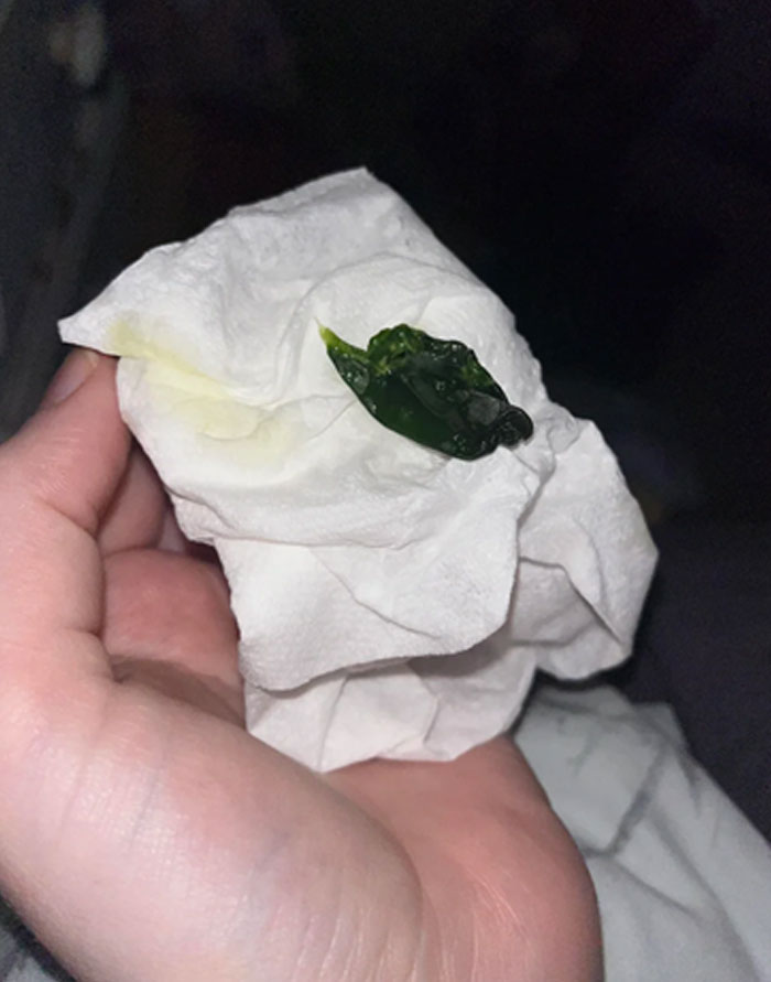 This Was Stuck Up My Nose For 12 Hours Until I Blew It Out At 5am