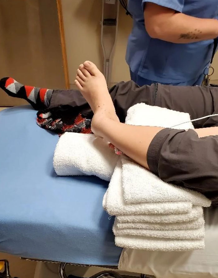 Dislocated My Ankle At A Trampoline Park (18m)