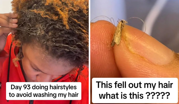 Moth In Hair After Not Washing It For 3 Months