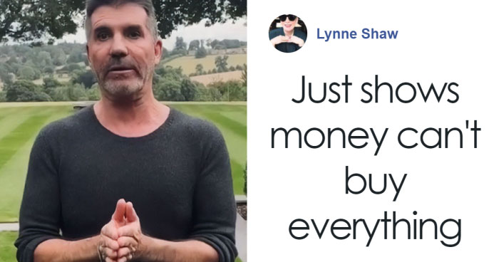 “What On Earth Has He Done?“: Simon Cowell Reveals Dramatic Facial Change