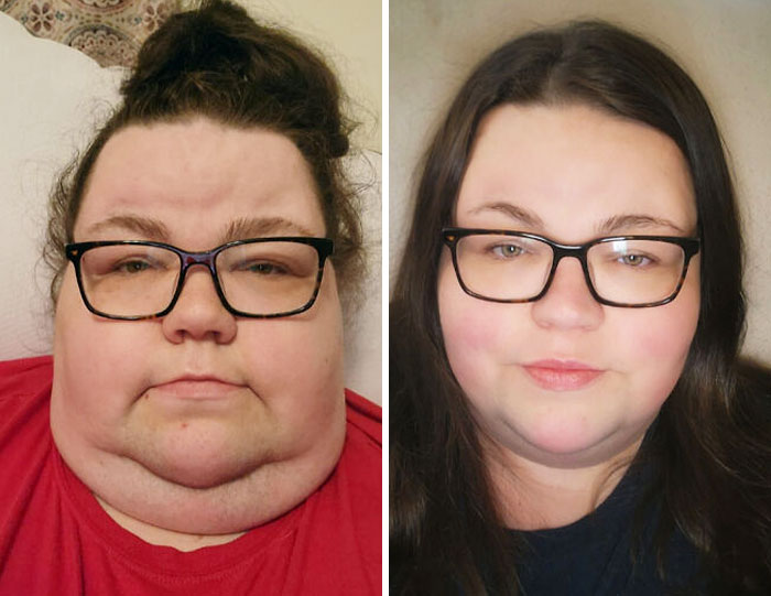 Started At 386 Lbs, 80 Lbs Lost Since June 2022. Got Diagnosed With Diabetes After A Super Close Call With Covid. Started Low Carb And Walking. Major Skin And Hair Improvement Too