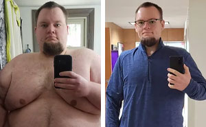 50 Times People Surprised Everyone By Losing So Much Weight They Looked Like A Different Person (New Pics)