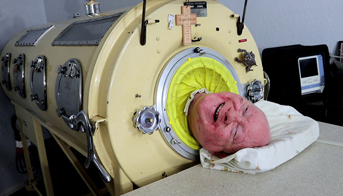 “Polio Paul” Passes Away After Spending 70 Years In Iron Lung, Leaves Impressive Legacy