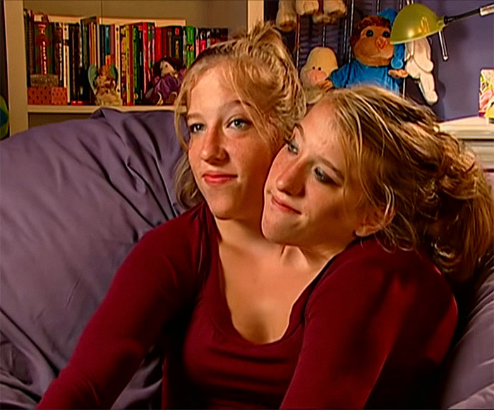 Conjoined Twins Brittany and Abby Fire Back At Negative Comments On Abby’s Marriage To Josh
