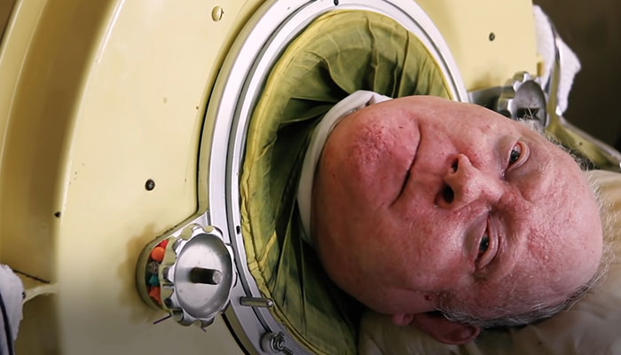 “Polio Paul” Passes Away After Spending 70 Years In Iron Lung, Leaves Impressive Legacy