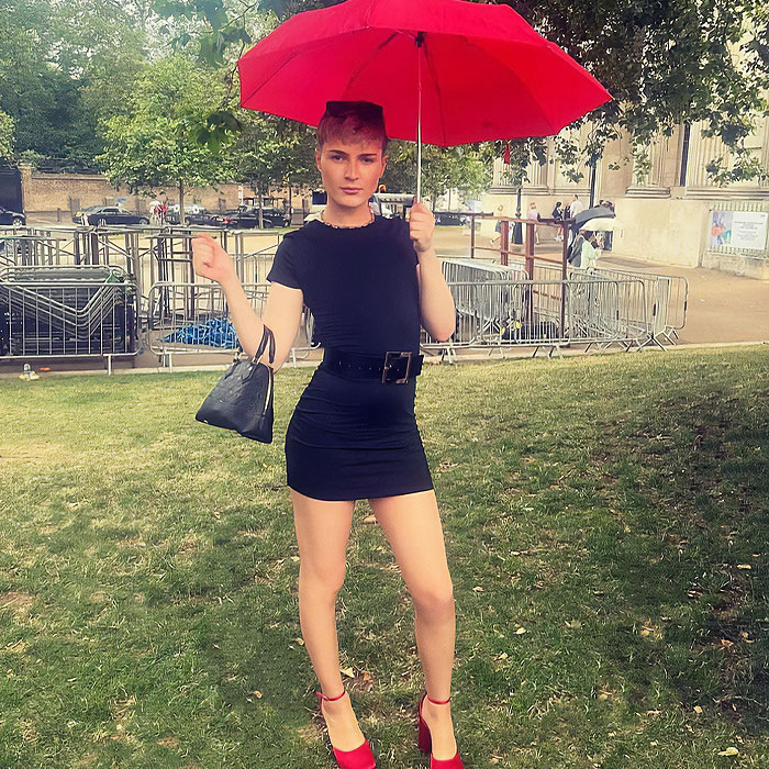 Activists Share Before And After Photos Of Their “Cheaper” Plastic Surgeries In Turkey Activists Share Before And After Photos Of Their “Cheaper” Plastic Surgeries In Turkey