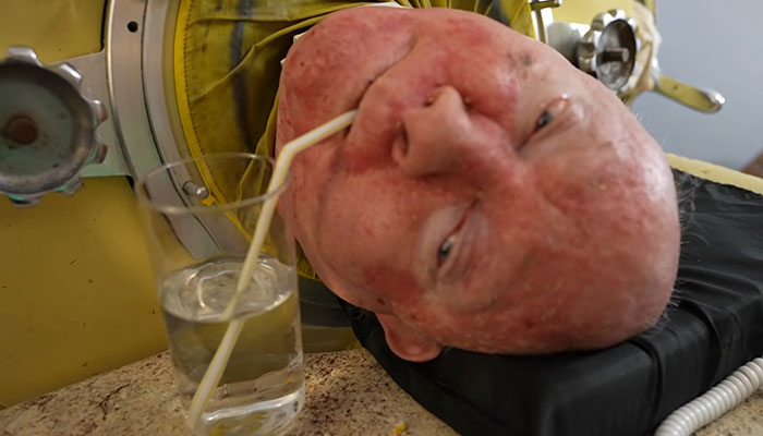 “Polio Paul” Passes Away After Spending 70 Years In Iron Lung, Leaves Impressive Legacy