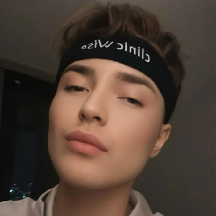 Activists Share Before And After Photos Of Their “Cheaper” Plastic Surgeries In Turkey Activists Share Before And After Photos Of Their “Cheaper” Plastic Surgeries In Turkey