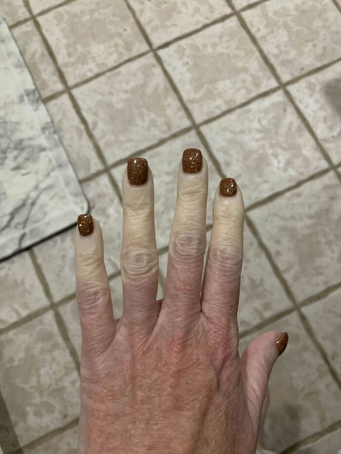 Los dedos de mi madre cuando tiene frío