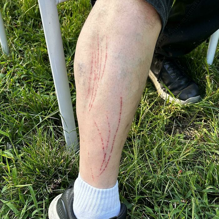 My Dad Has These Scratches On His Leg But Has Zero Idea What They Could Be From. Any Idea?