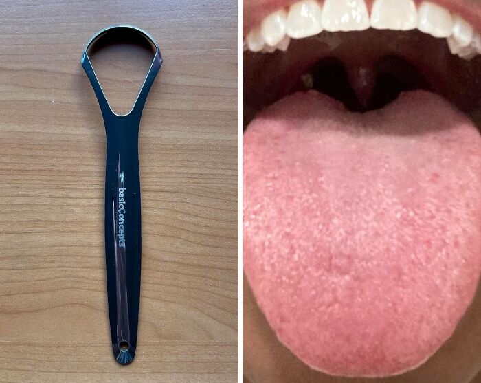 Refresh Your Oral Hygiene With Basic Concepts Tongue Scraper For Adults