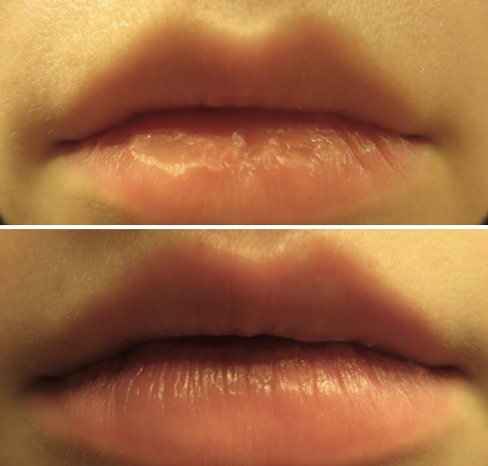  Laneige's Lip Treat: Sleep Your Way To Softness With Antioxidants & Vit C!
