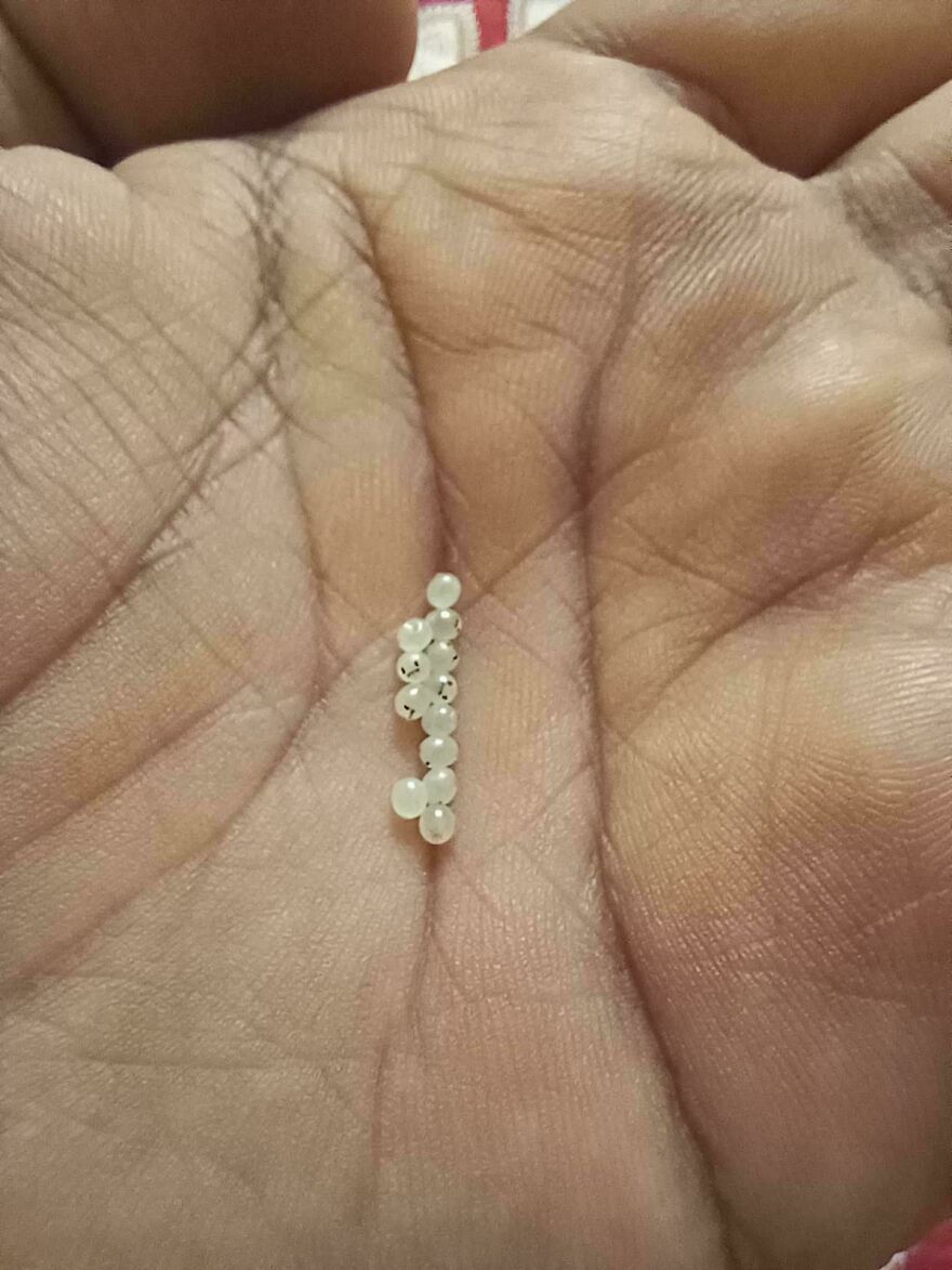 Found These Tiny White Balls With Faces On Them
