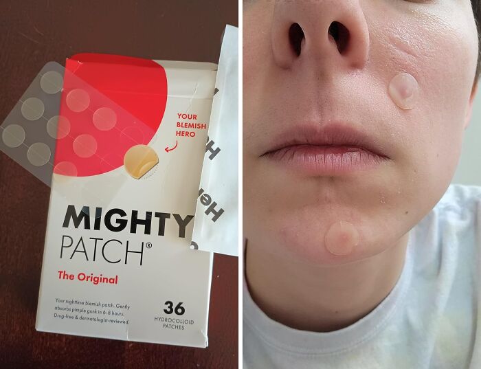 Hide And Heal: The Mighty Patch Pimple Plan