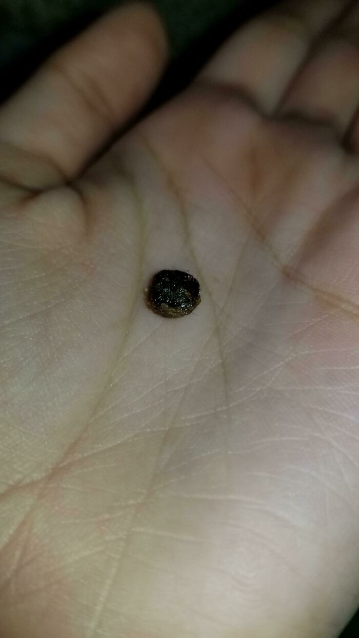 Found This In My Ear