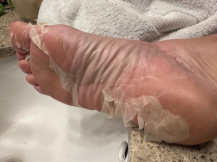 Baby Soft Feet, Who? Try The Foot Peeling Mask For A Total Reboot!