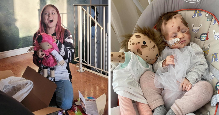 Woman Creates Inclusive Dolls Representing Their Owners That Face Rare Health Conditions (30 Pics)