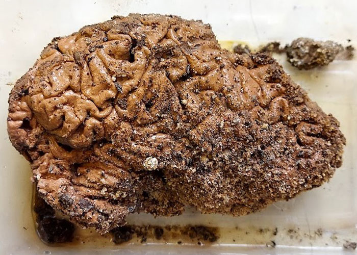 Scientists Try To Explain Why 4,400 Brains Have Managed To Survive, Some Over 12,000 Years