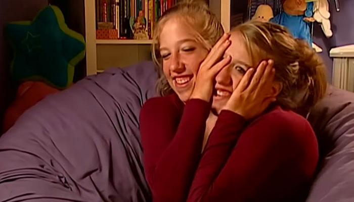 Dicephalus-Conjoined Twin Abby Hensel Of “Abby & Brittany” Is Married