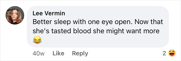 Woman Says The Bond With Her Cat Was Strengthened After The Cat Sneakily Consumed Her Toe Woman Says The Bond With Her Cat Was Strengthened After The Cat Sneakily Consumed Her Toe