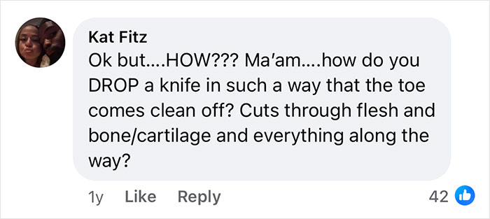 Woman Says The Bond With Her Cat Was Strengthened After The Cat Sneakily Consumed Her Toe Woman Says The Bond With Her Cat Was Strengthened After The Cat Sneakily Consumed Her Toe