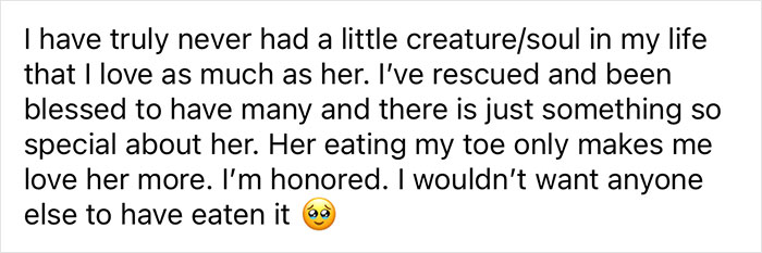 Woman Says The Bond With Her Cat Was Strengthened After The Cat Sneakily Consumed Her Toe Woman Says The Bond With Her Cat Was Strengthened After The Cat Sneakily Consumed Her Toe