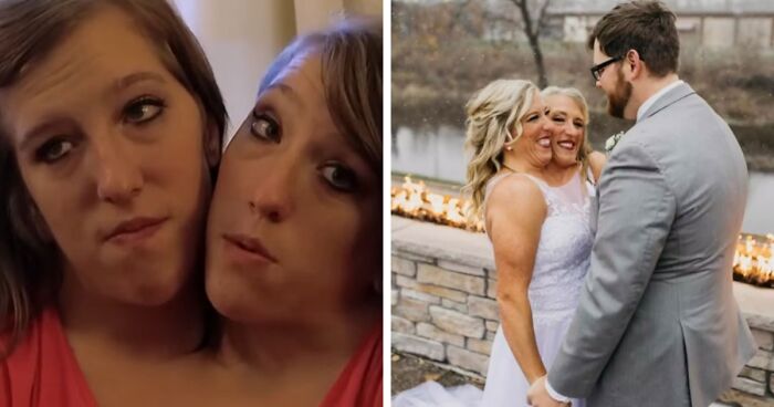 Conjoined Twin Abby Hensel Tied The Knot With US Veteran During Private Ceremony