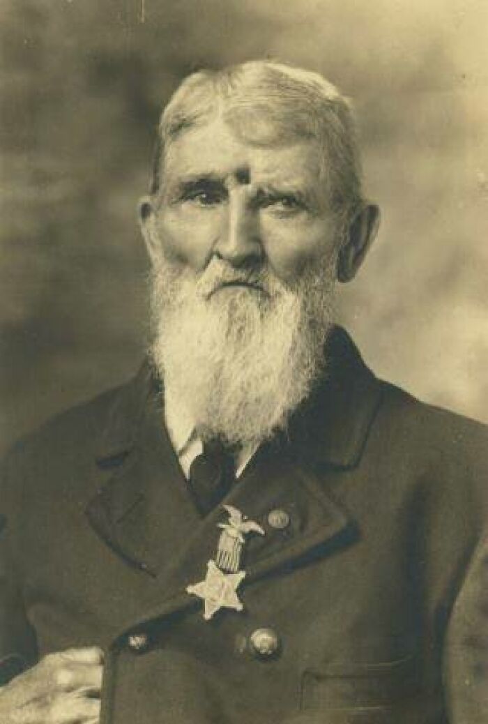 Civil War Veteran Jacob Miller (Company K 9th Indiana Vol. Inf) Was Shot In The Forehead On Sept.19th, 1863 At Brock Field At Chickamauga And Left For Dead